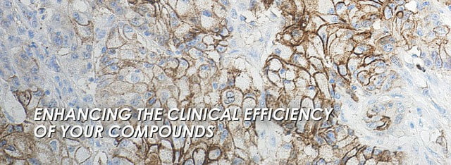 Learning About Alpha-1 Antitrypsin Deficiency - 2